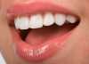 Красивые зубы с винирами и люминирами